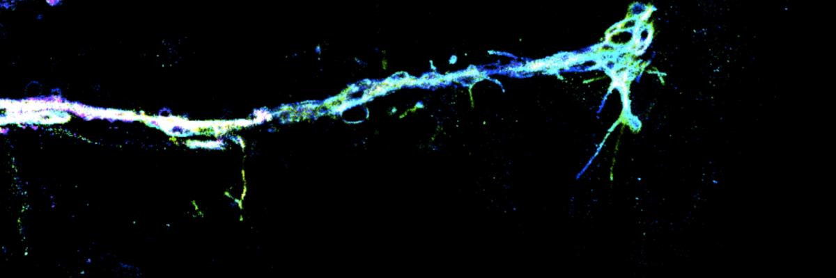 Super-resolution imaging of neurons